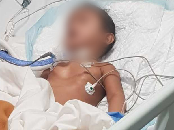 9 Months Old Baby Of Shruthi Needs Your Help Fight Pierre Robin Sequence