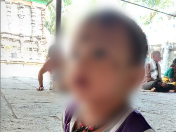 11 months old Lakshmi Chetan needs your help fight Head injury