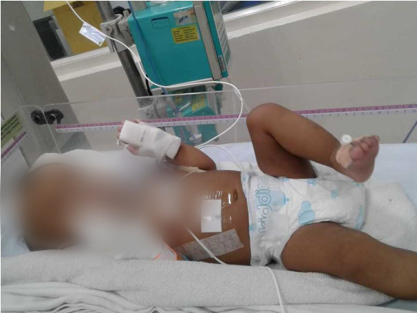 Support Gracy Recover From Hydrocephalus