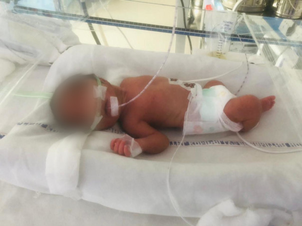 15 Days Old Babies Of Kalyani Need Your Help