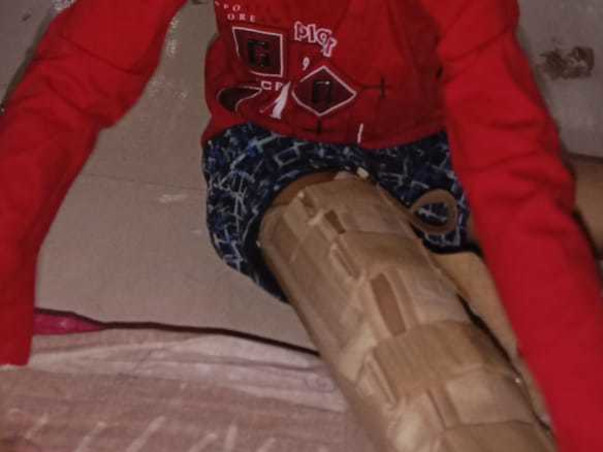 Support Kabir 7yrs Old To Recover From Osteosarcoma