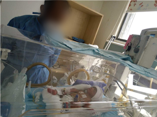 Premature Baby Needs Prolonged NICU To Survive