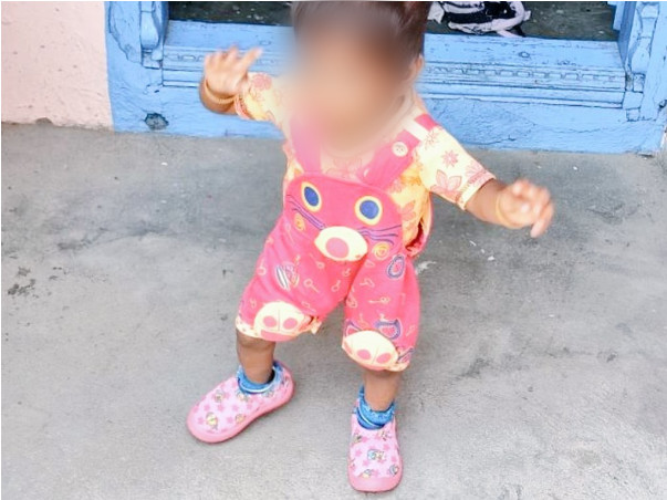 Help 1 Year Old Son Aravindh For Surgery