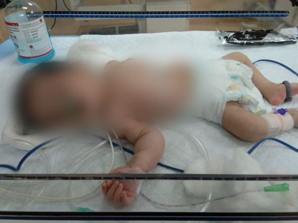 Support Baby Of Akhila To Recover From Msud Maple Syrup Urine Disease