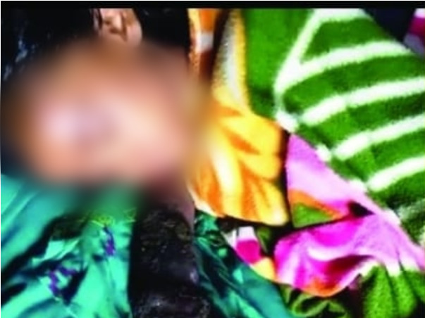 Help Manju Recover From Snake Bite