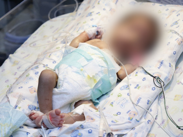 Support Baby of Rajni recover from Preterm baby