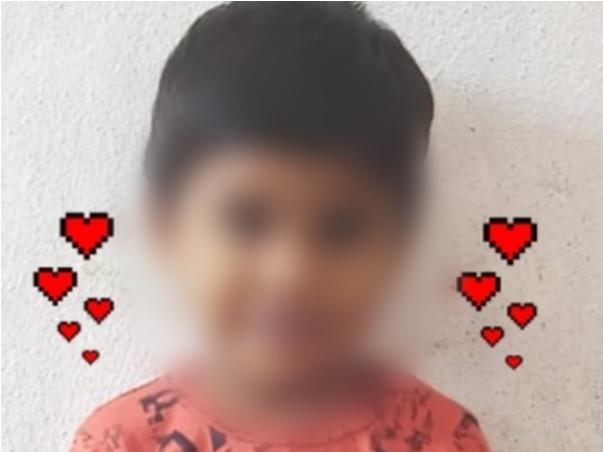 4 Years Old Rohith Needs Your Help Fight Deep Scald Burns