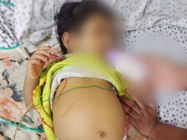 Support Aayat Unissa To Recover From Liver Damage
