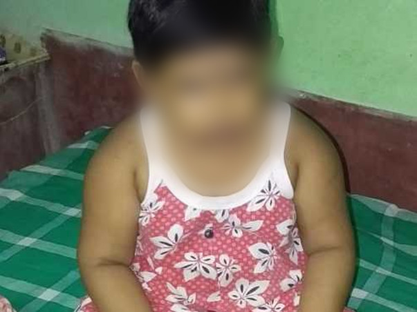 5 Years Old Snehoshi Ganguly Needs Your Help To Recover From ROHHAD(NET) Syndrome