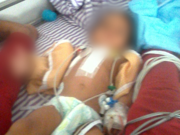Support 8 Months Old Atrika Atha Undergo Cardiac Surgery