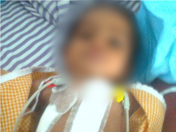Support 8 Months Old Atrika Atha Undergo Cardiac Surgery