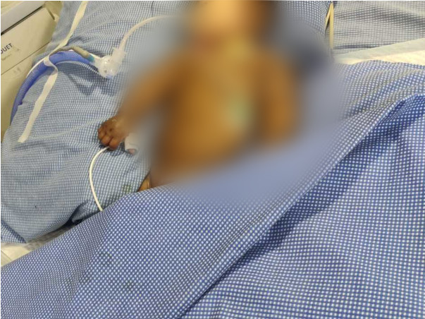 4 Months Old K Hayan Needs Your Help To Recover From Heart Problem