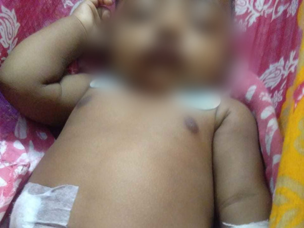 Support 5 Months Old Dripto Das To Undergo Liver Transplant...