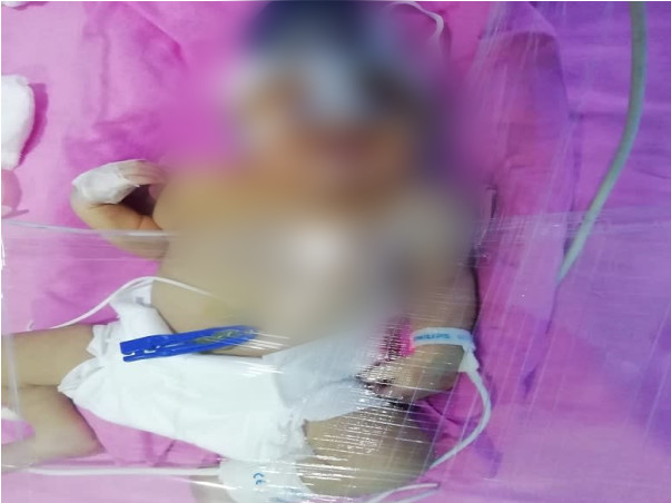 5 Days Old BABY Needs Your Help