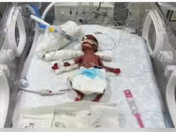 My Baby Twins Battle For Their Life And We Need Your Support To Save