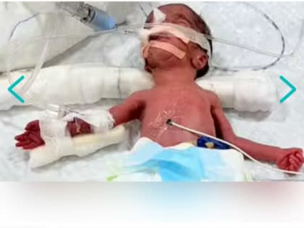 My Baby Twins Battle For Their Life And We Need Your Support To Save