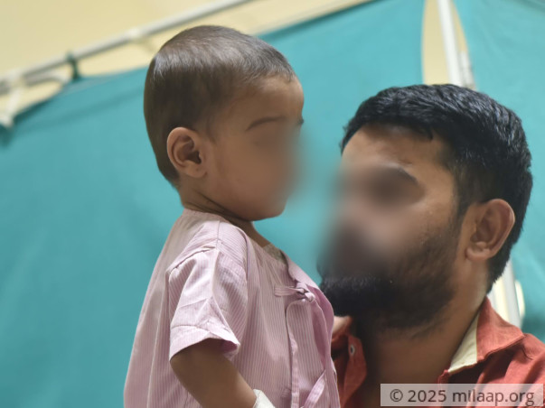 Help Shree Navnath Recover From ASD Patch Suture Line Dehiscence