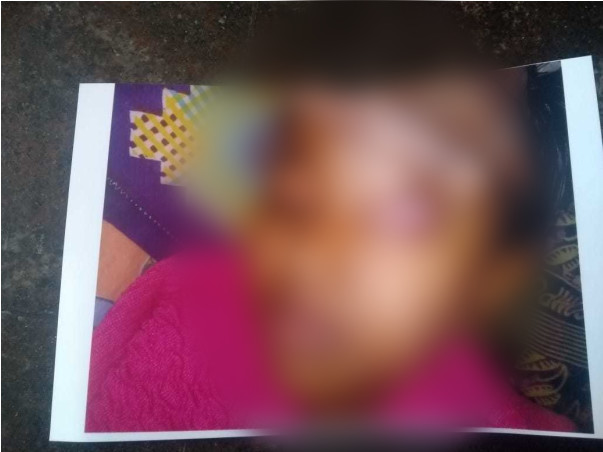 8 years old Shajidha needs your help fight Acute Myeloid Leukemia