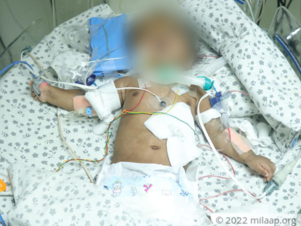 A Terrible Lung Infection Is Making This 5-Month-Old Cough Up Blood