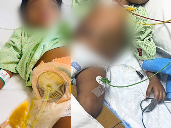 Hope for Pratish: Supporting a 3-Year-Old's Fight for Life
