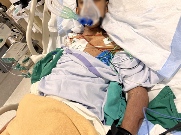 Help my brother fight Gastrointestinal Bleeding and infection