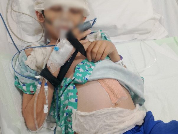 Support child of IROM BIMORANIBALA DEVI