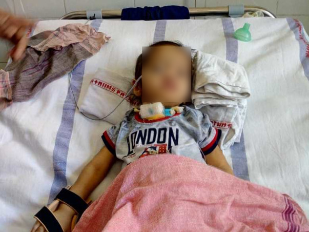 2 Years Old Aditi Kumari Needs Your help Fight Neuro Disease