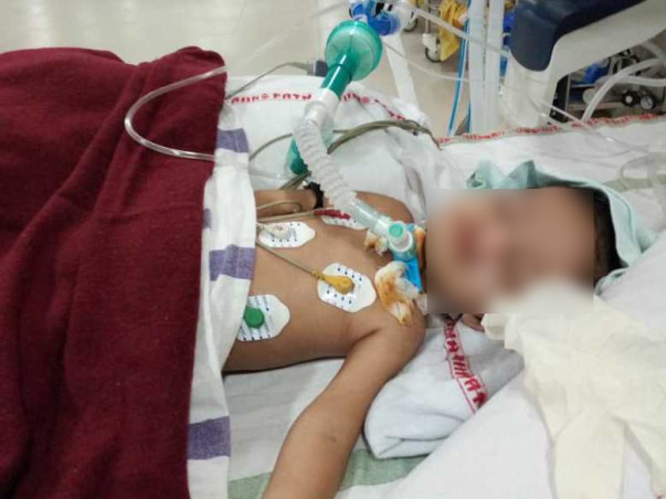 2 Years Old Aditi Kumari Needs Your help Fight Neuro Disease