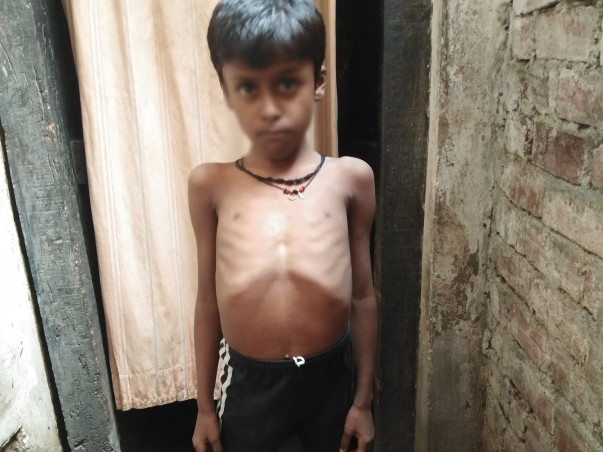 9 years old Sangam needs your help fight DUCHENE MUSCULAR DYSTROPHY