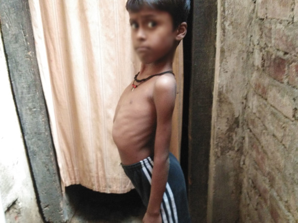 9 years old Sangam needs your help fight DUCHENE MUSCULAR DYSTROPHY