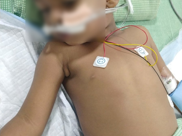 Help my son fight Multiple Organ Disorder