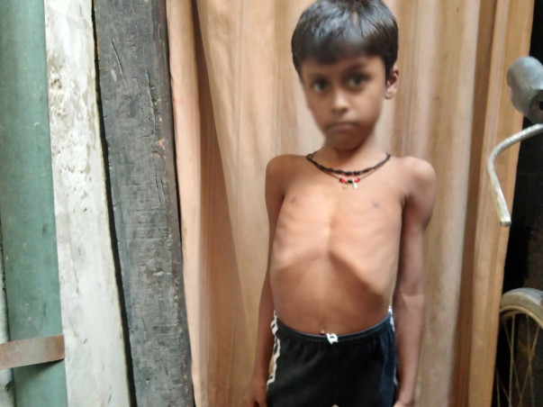 9 years old Sangam needs your help fight DUCHENE MUSCULAR DYSTROPHY