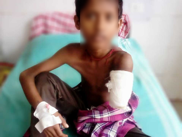 Help 7 Years Old Ramdas  To Undergo Plastic Surgery