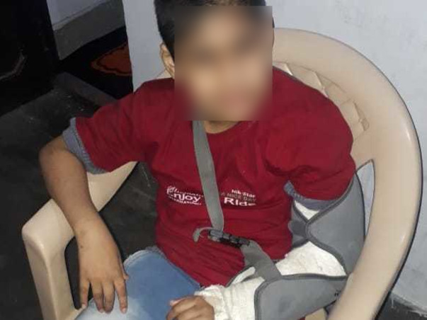 Support Adnan And Rehan Recover From Blindness And Disability