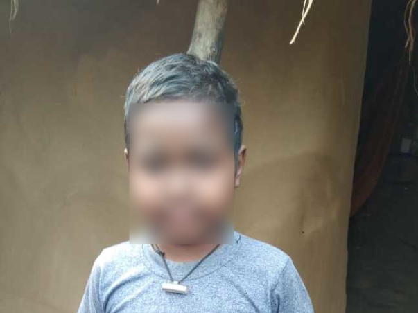 10 Years Old Krish Mallick Needs Your Help Fight Lupus