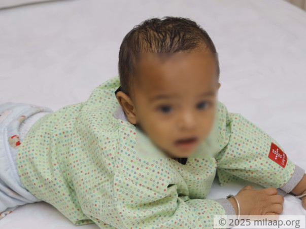 Master Shivam orchidopexy