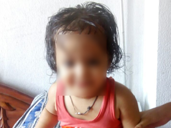2 Years Old Aditi Kumari Needs Your help Fight Neuro Disease