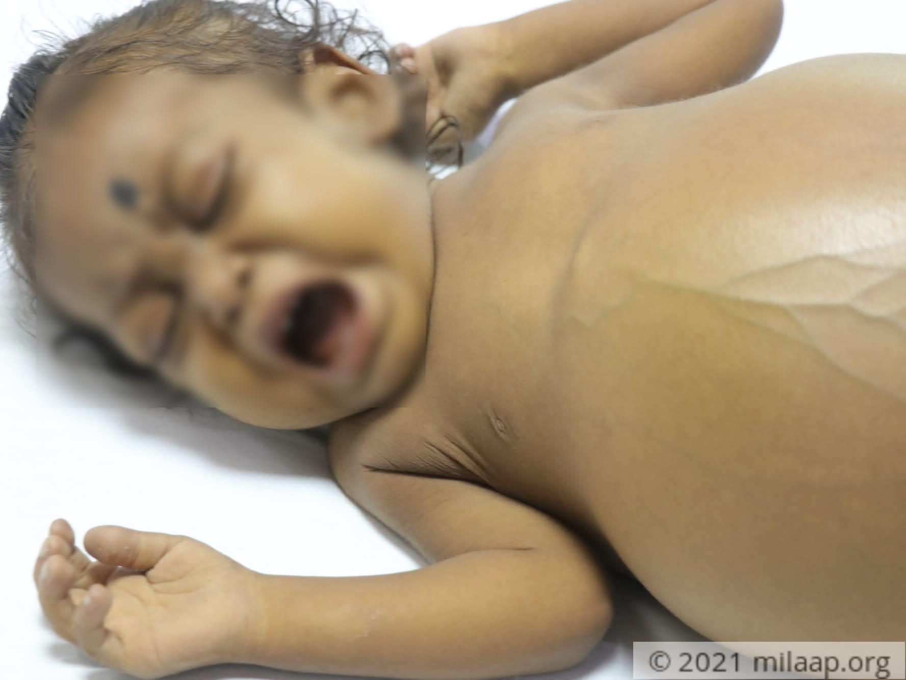 Img 9529 vhjulk 1638030159 pxayve 1638172335