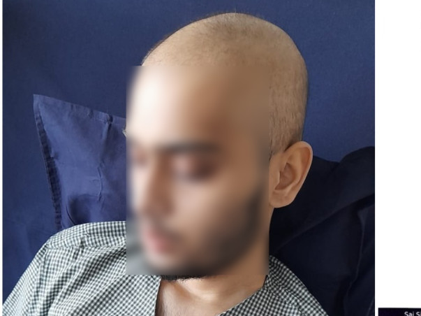 Support Hazari Siddharth To Recover From Acute Lymphoblastic Leukemia