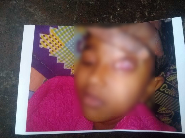 8 years old Shajidha needs your help fight Acute Myeloid Leukemia