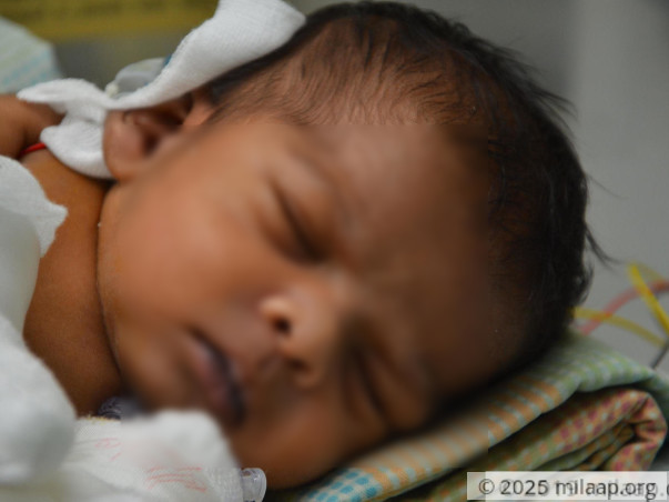 Baby of vijalakshmi needs your help to survive