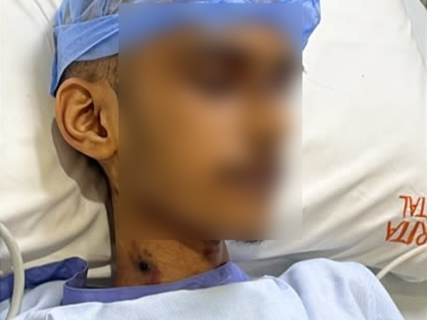 Help my brother fight Gastrointestinal Bleeding and infection