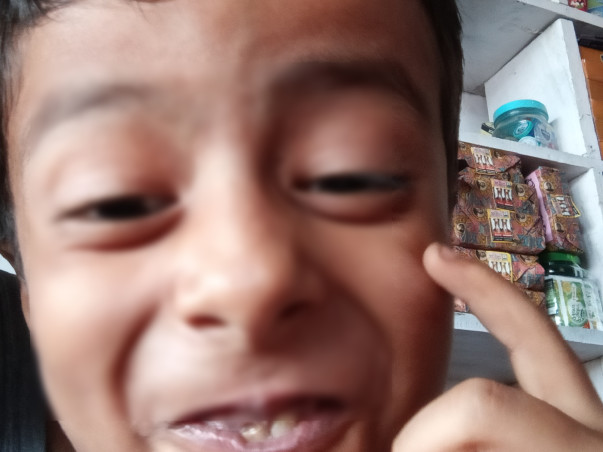 Help My Son Undergo Operation of Both Legs