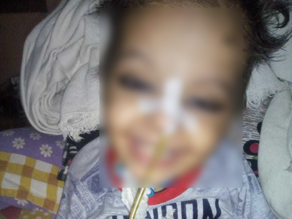 2 Years Old Aditi Kumari Needs Your help Fight Neuro Disease