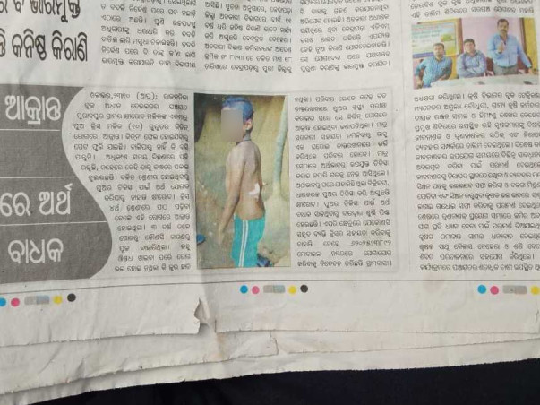 10 Years Old Krish Mallick Needs Your Help Fight Lupus
