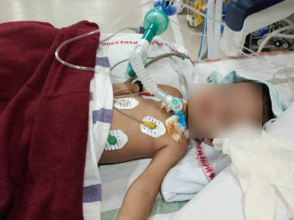 2 Years Old Aditi Kumari Needs Your help Fight Neuro Disease