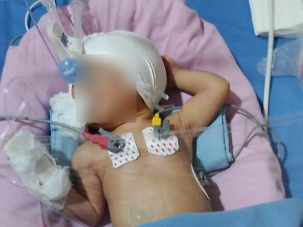 Help Save Our 3-Day-Old Baby Girl Fighting for Life in NICU