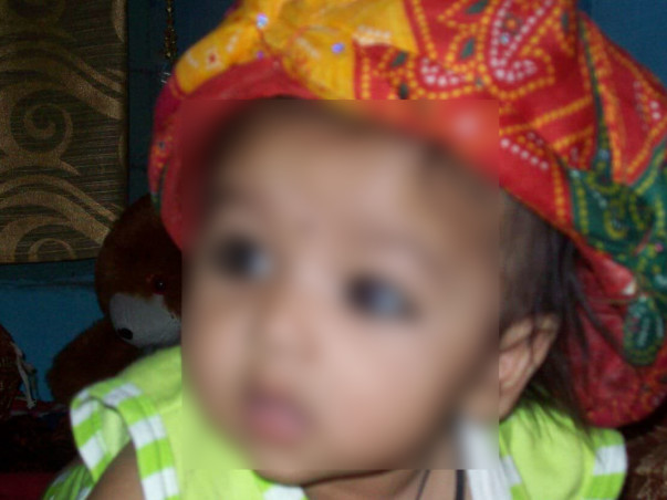 Save Swara 's Life,a 9 Month Old Baby, Help Her Fight Thalassemia
