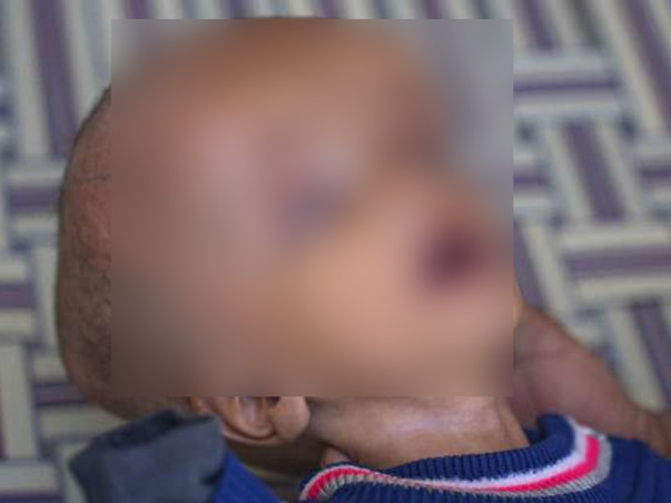 help-son-of-tahir-recover