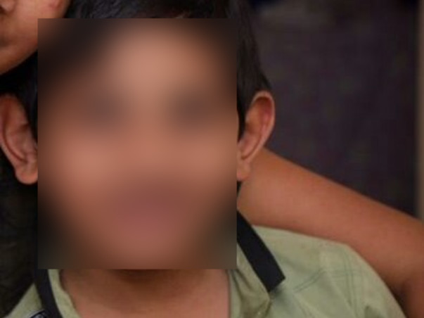 Help my son fight cochlear implant for sensorineural hearing loss treatment